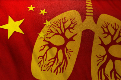 世界マーケティング短信:新型ウイルス対策に動き出したブランド